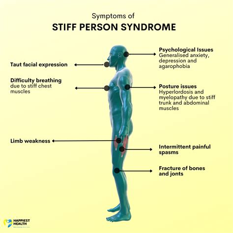 life expectancy stiff person syndrome